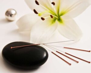 Beauty akupunktura